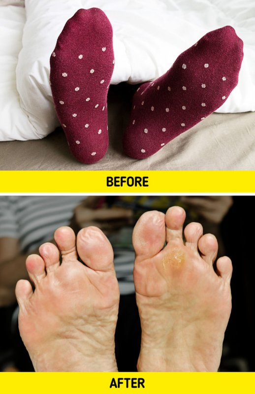 Что может произойти, если вы спите в носках1